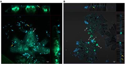 Interplay between the microalgae Micrasterias radians and its symbiont Dyadobacter sp. HH091